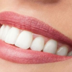 Meet your Posher, Ymane